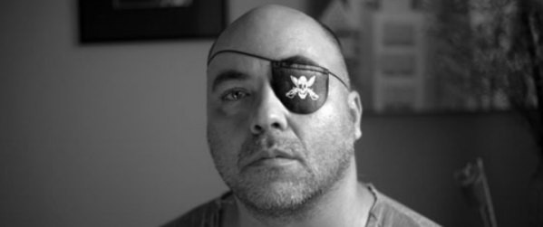 O fotógrafo Alex Silveira perdeu a visão do olho esquerdo após ser atingido por uma bala de borracha - (Foto: Sérgio Silva/Ponte Jornalismo)