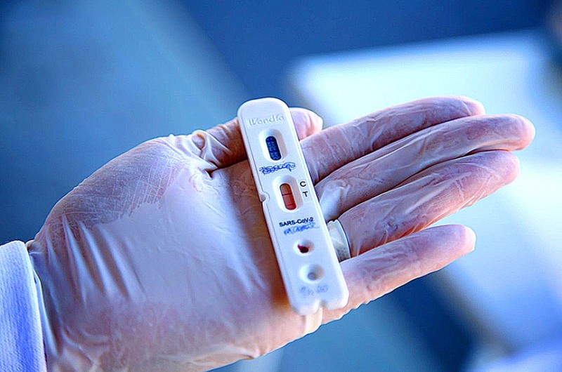 Teste rápido de covid-19: ideia é facilitar acesso da população mais pobre aos autotestes, para prevenir contágio - Leonardo Souza/PMF