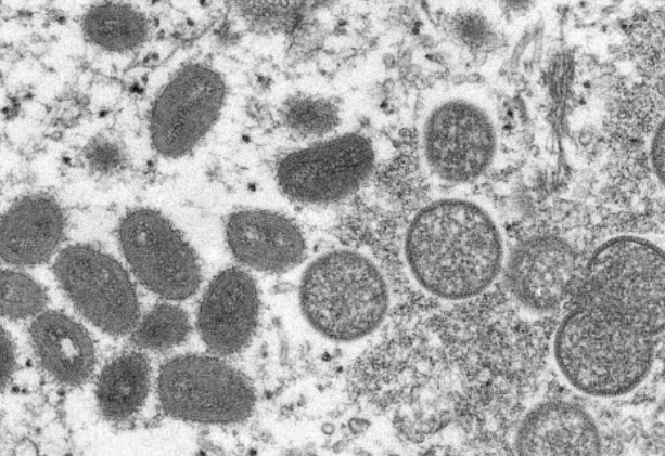 Imagem de microscópio mostra vírus causador da varíola do macaco — Foto: Cynthia S. Goldsmith, Russell Regner / CDC via AP