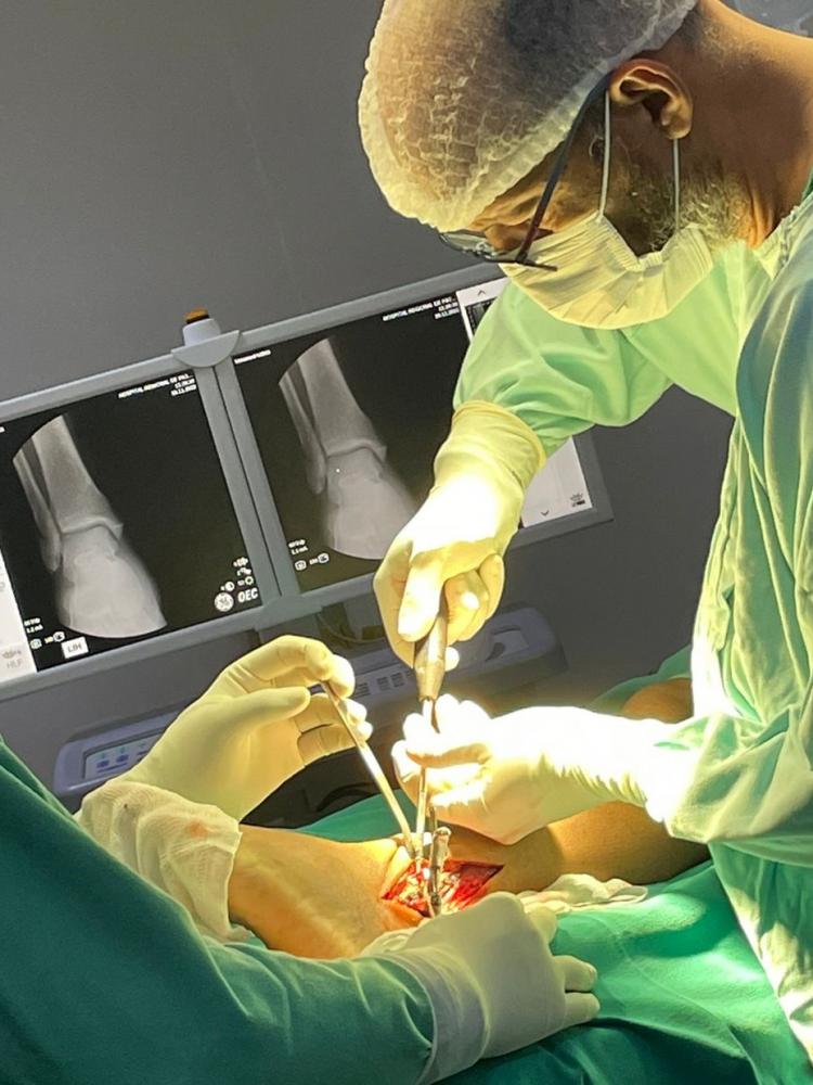 O Hospital de Patos é também referência para cirurgias ortopédicas, sendo a especialidade que mais registrou procedimentos em 2022 com 1.351