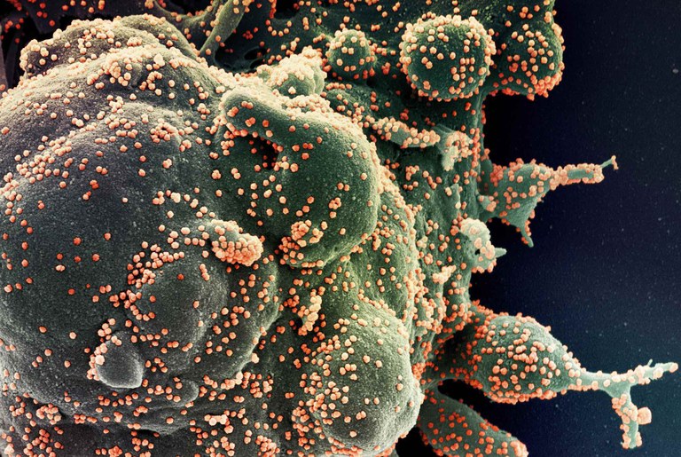 Novo coronavírus atacando células (Foto: Divulgação/NIAID)