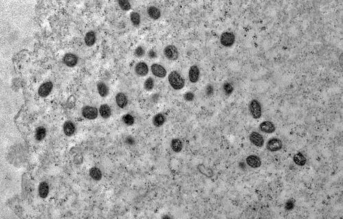 Foto: Reprodução Débora Barreto/IOC/Fiocruz