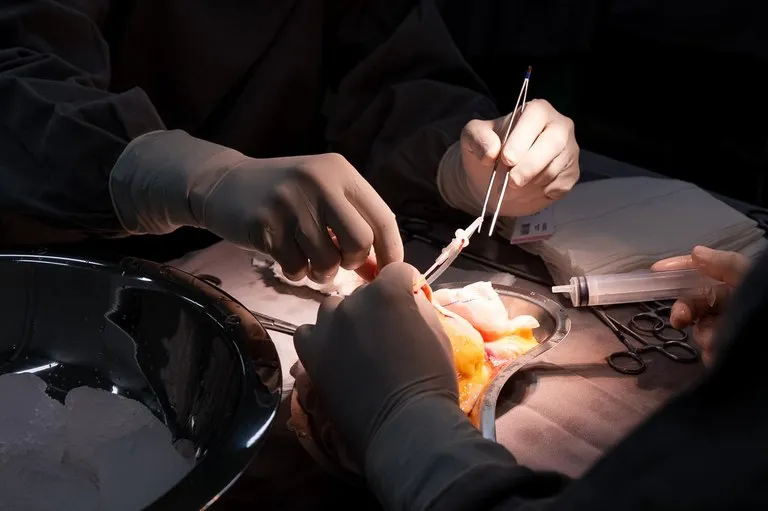 Paraíba realiza primeiro transplante renal 100% SUS no Hospital da Mulher