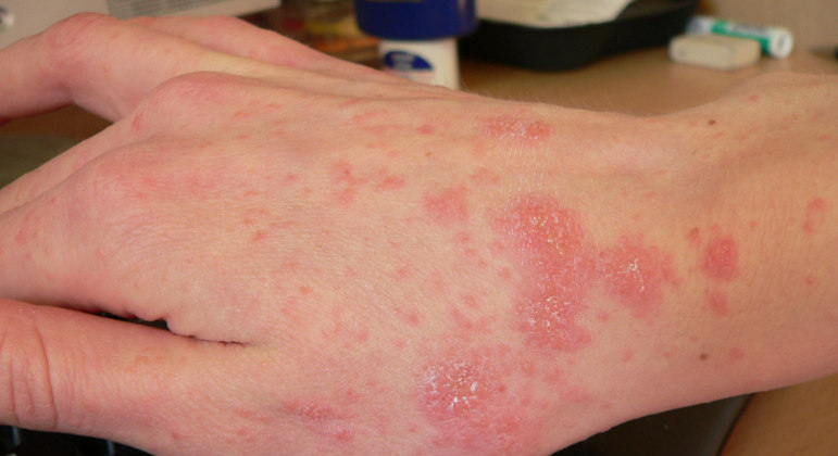 Foto: Imagem ilustrativa/Wikimedia Commons